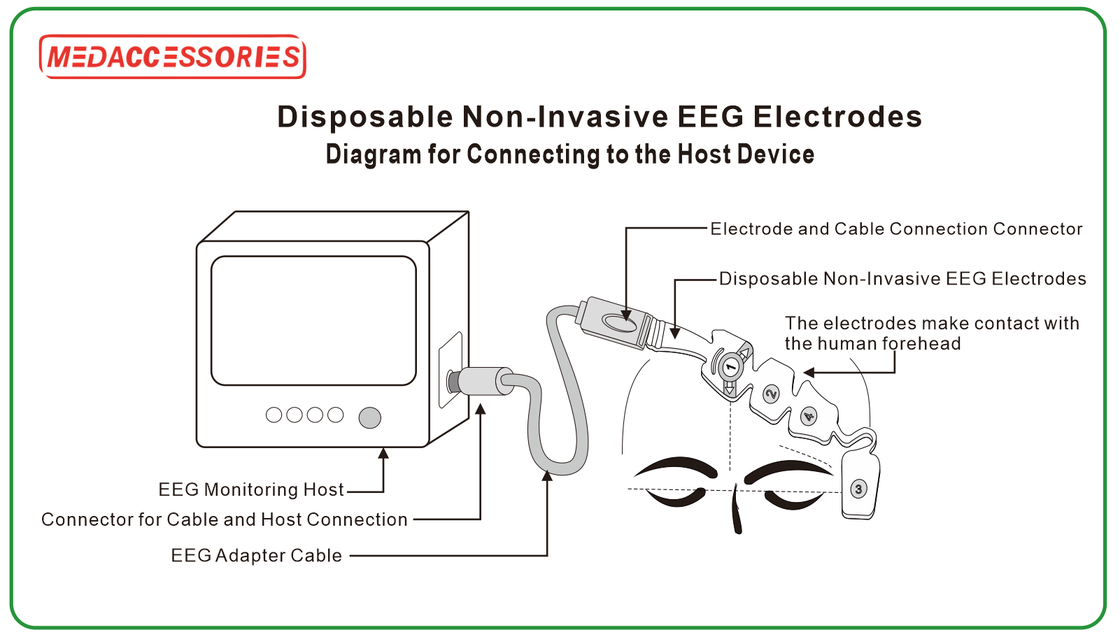 EEGセンサー 脳モニター 消耗用 麻酔深さ 非侵襲的なEEGセンサー BISセンサー EEG電極